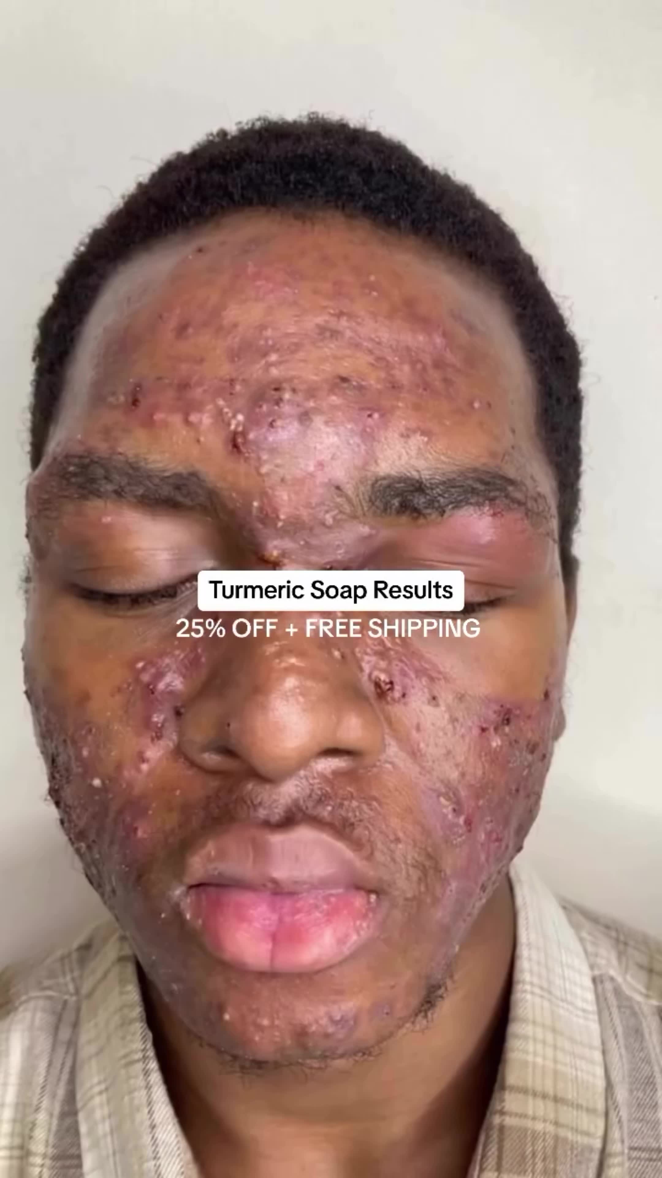Best Selling Skin Clean Soap