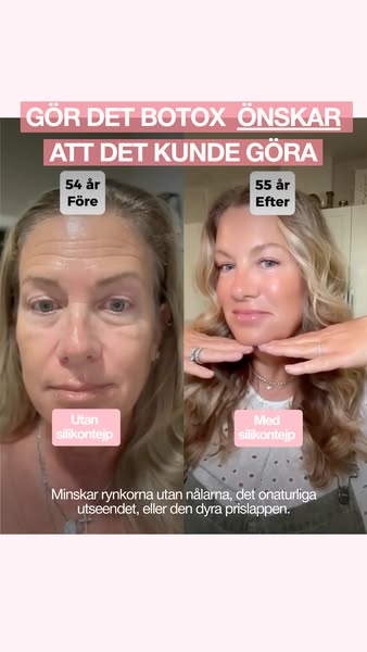 Du behöver inte botox för att minska rynkor.