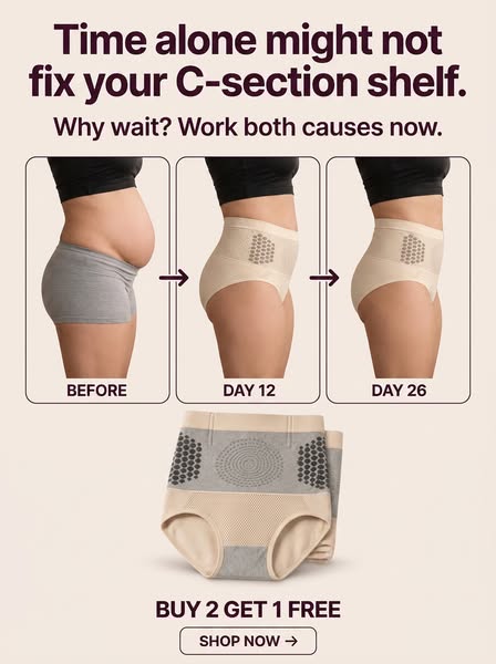 Why your c-section shelf won't leave.