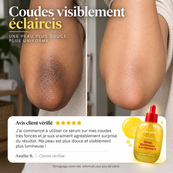 Éclaircissez les taches brunes, où qu’elles se trouvent