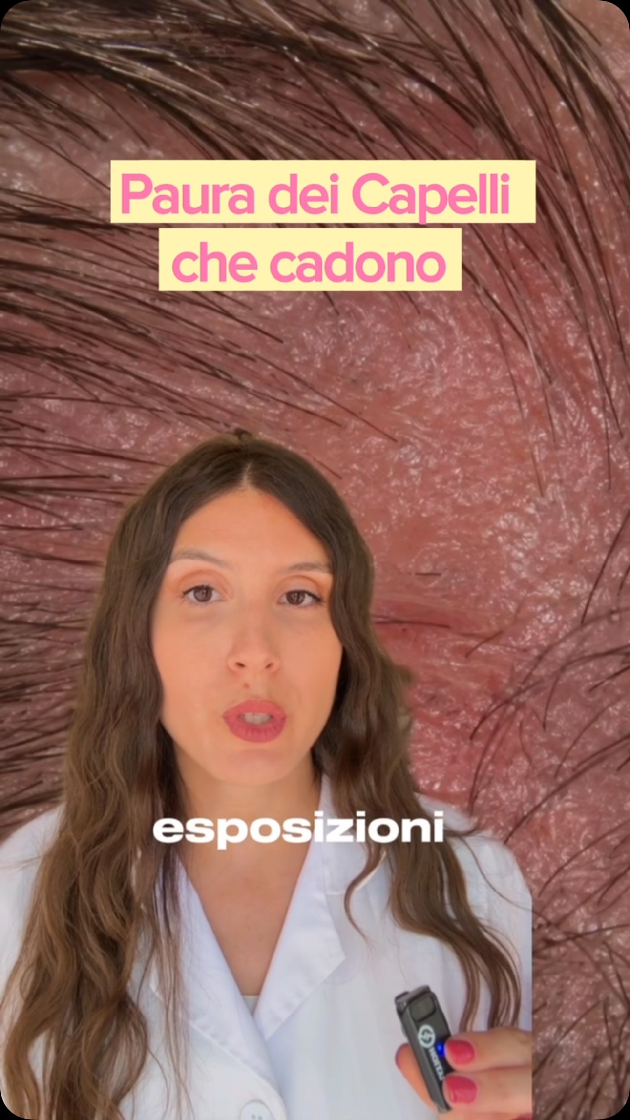 Proteggi il cuoio capelluto e previeni la caduta a Settembre