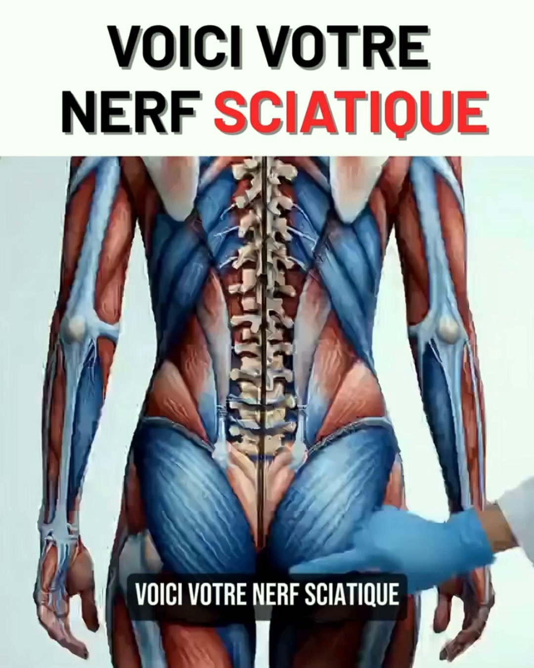 3 Façons de Soulager Votre Sciatique