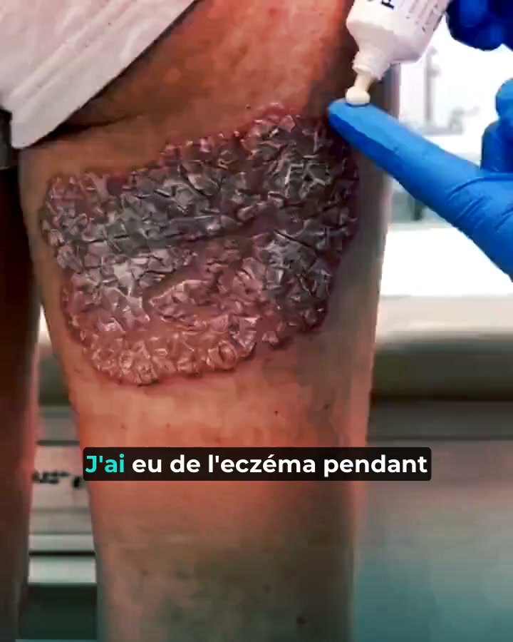 Enfin un soin qui apaise vraiment votre peau