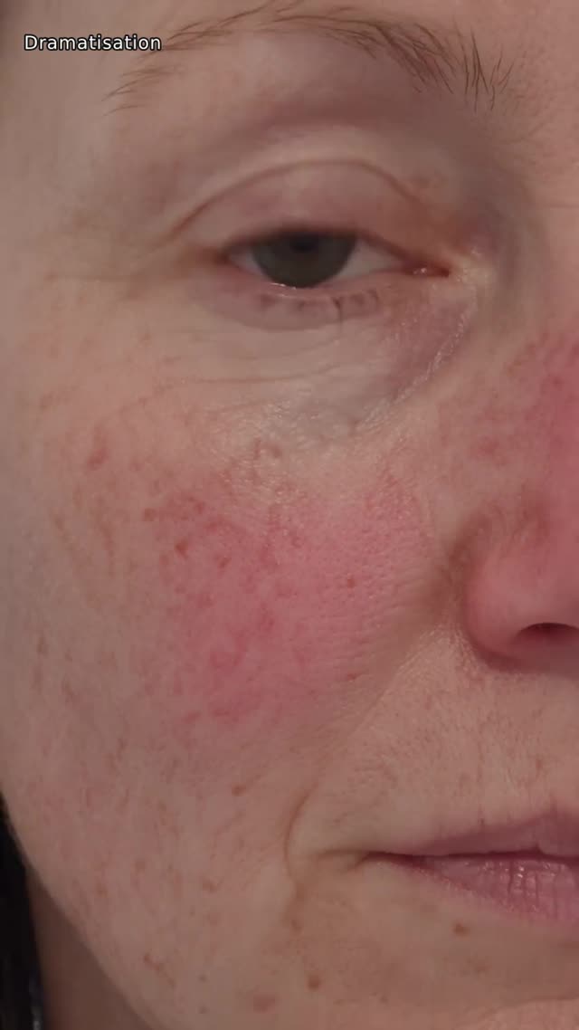 For skin that reacts to everything.