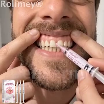 Cavity Repair | FDA-Recognized 10% Nano-Hydroxyapatite (NH-10) | Delivery Within 2–4 Business Days | Full Money-Back Guarantee