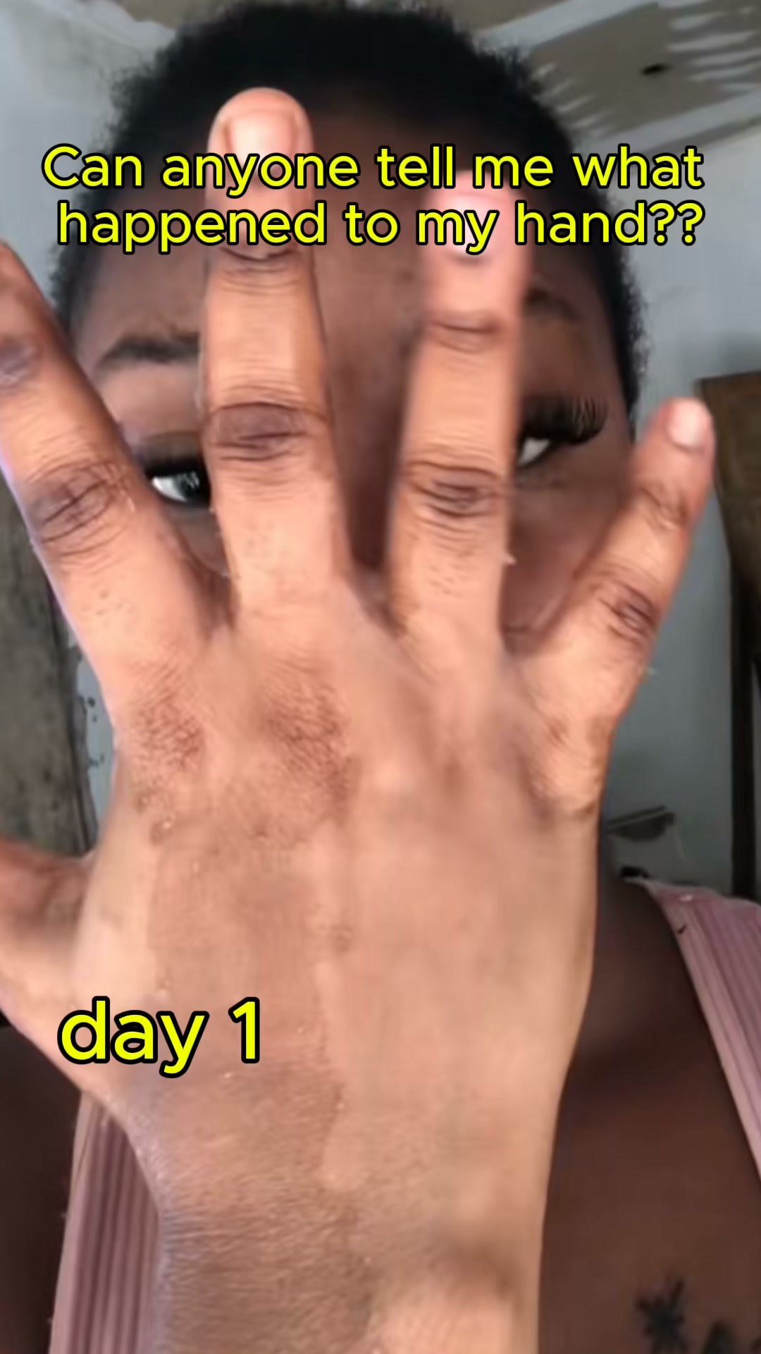 Follow the Hand-Peeling Journey