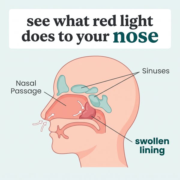 What's Really Blocking Your Nose
