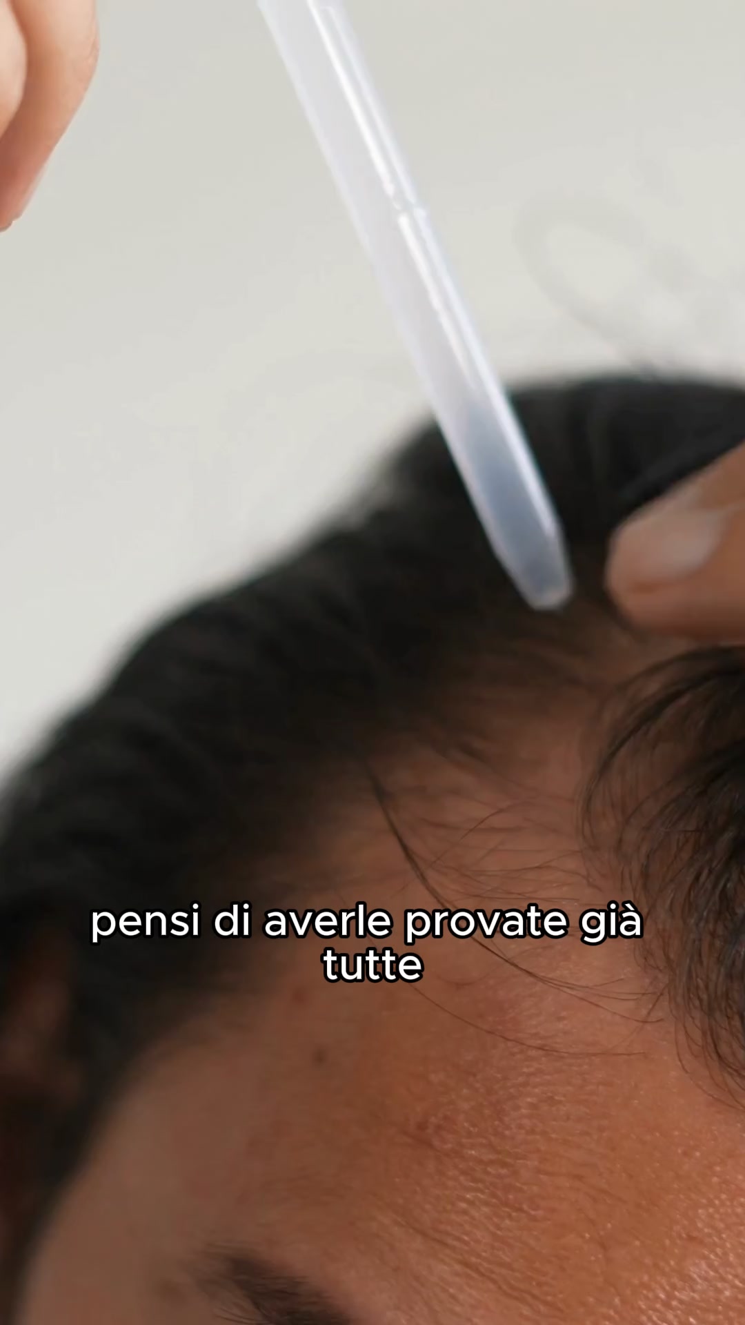 Capelli folti o rimborsato