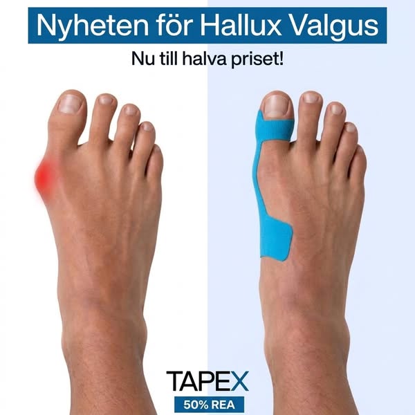 Hallux Valgus korrigeringstejp