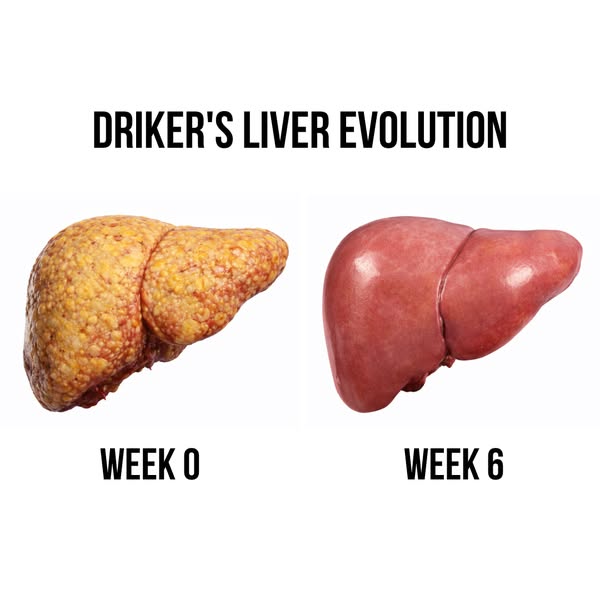 What Happy Liver Does to a Drinker's Liver in 8 Weeks