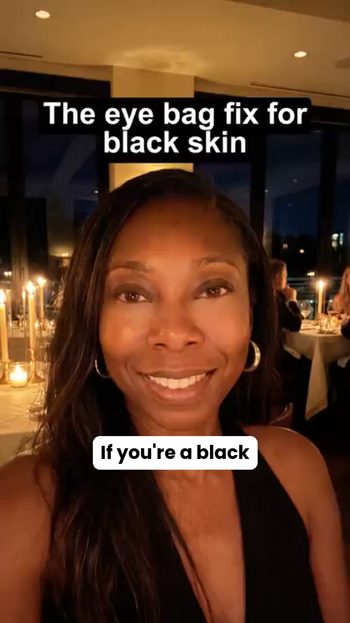 The eye bag fix for black skin