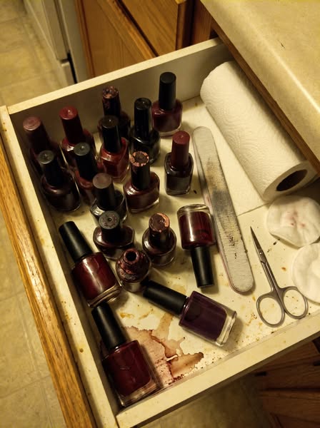 Read this if you have toe fungus