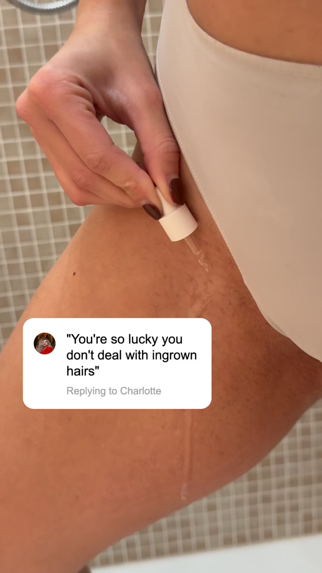 Say Goodbye to Ingrown Hairs
