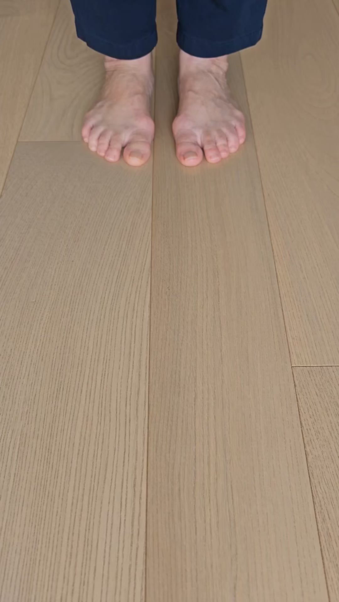 Vad händer egentligen vid hallux valgus? � (Se fotens anatomi)