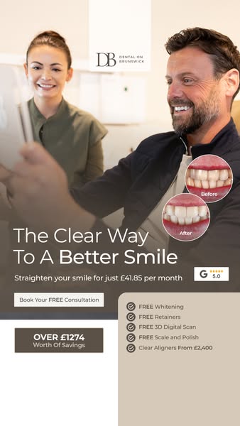 Clear aligners. Big smile energy