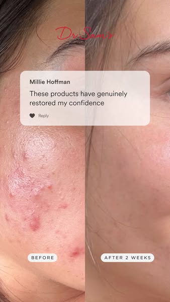 A complete routine for bright, clear skin