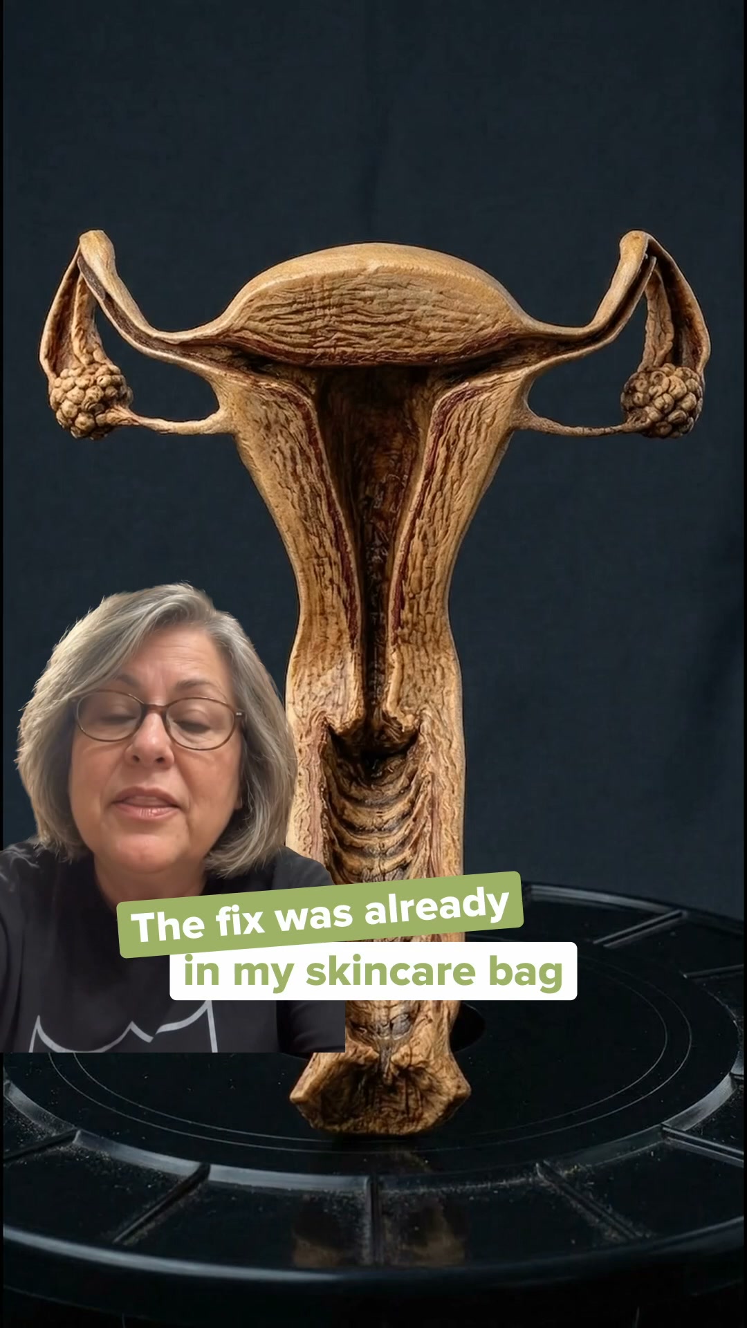Dryness deserves moisture support