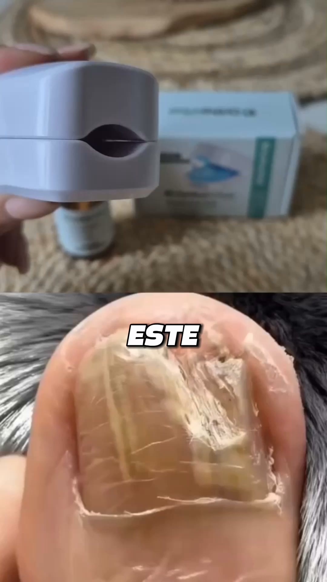 70% de Descuento + Aceite