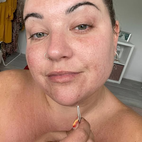Read this if you want to get rid of chin hair