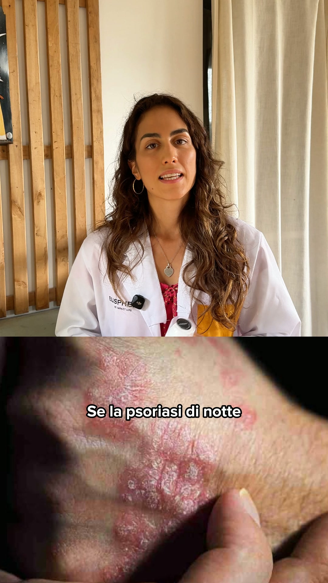 Supporto naturale per la tua Psoriasi