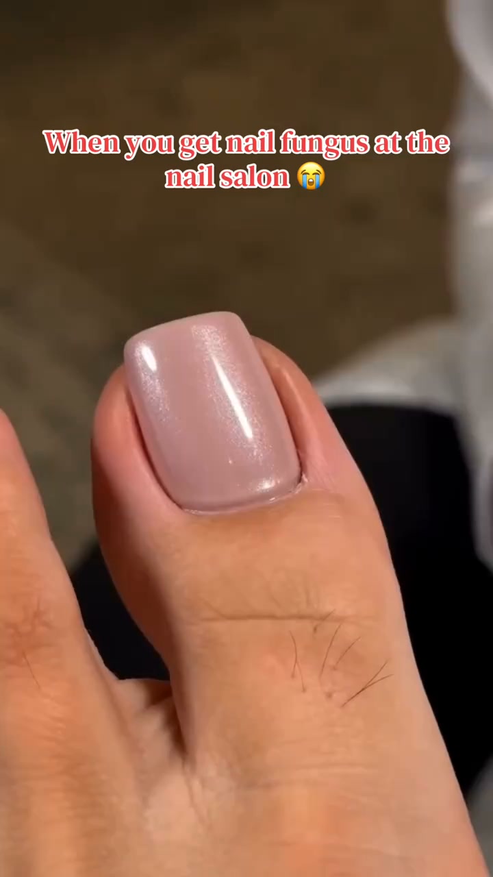 When a relaxing pedicure turns into a nightmare... CURE nail fungus at the root!