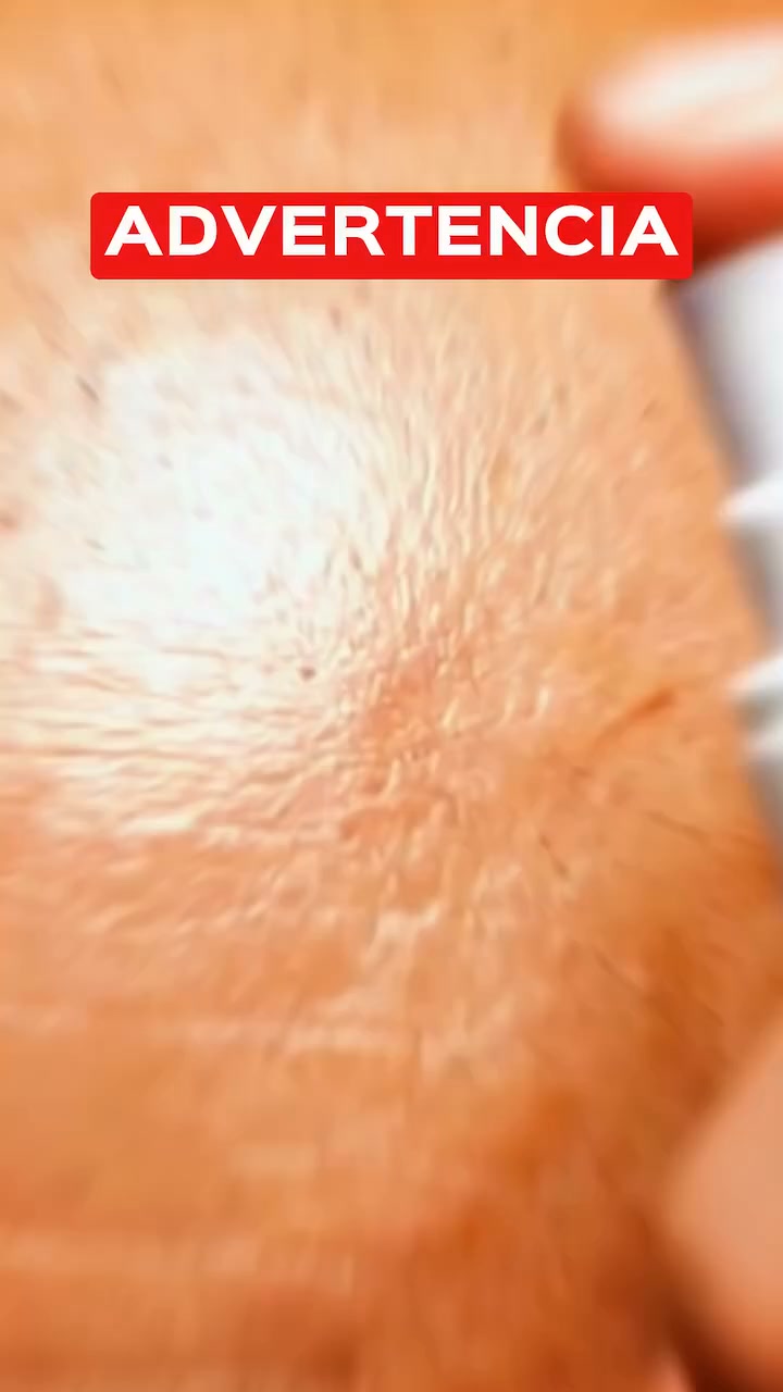Cabello Más Abundante y Fuerte