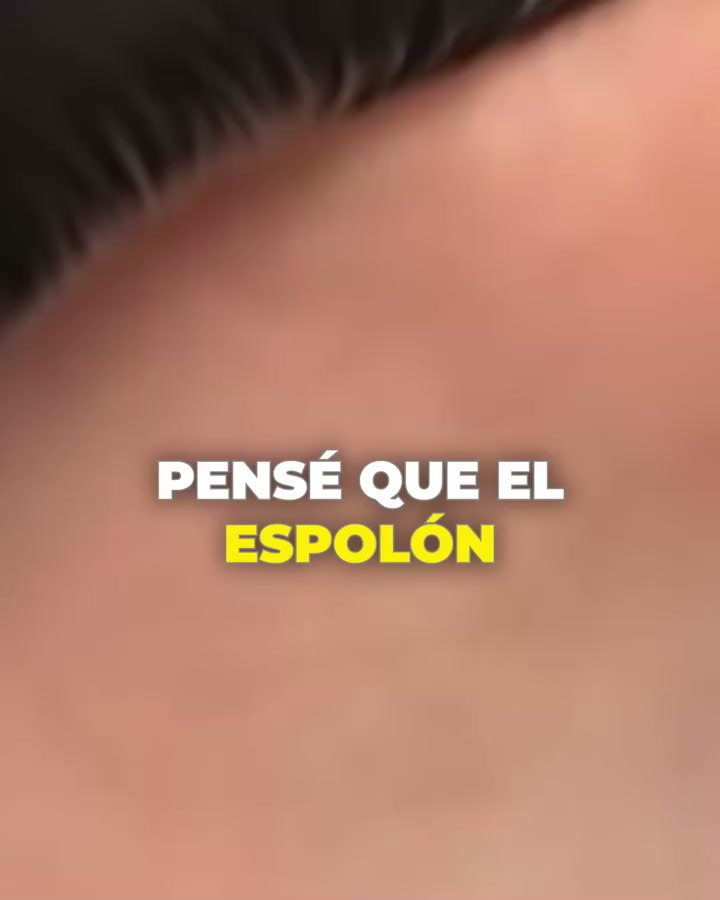 Pago contra entrega