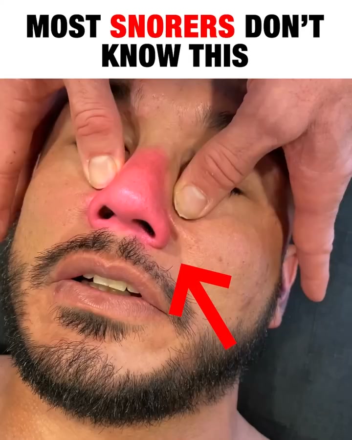 Snoring Stops Here!