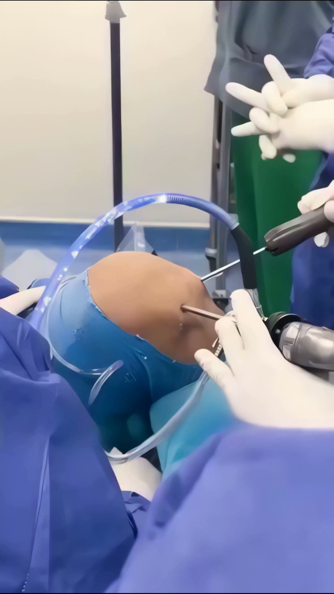 Knieschmerzen oder Arthrose?