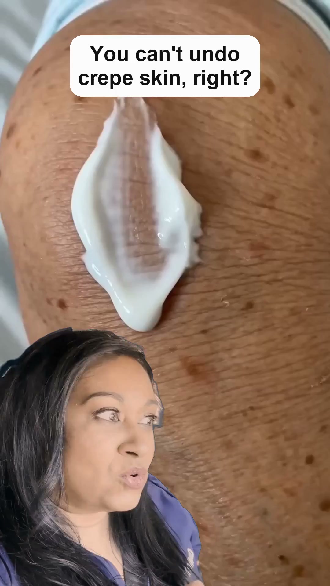 Why Lotions Don’t Work for Crepey Skin (and What Actually Does)