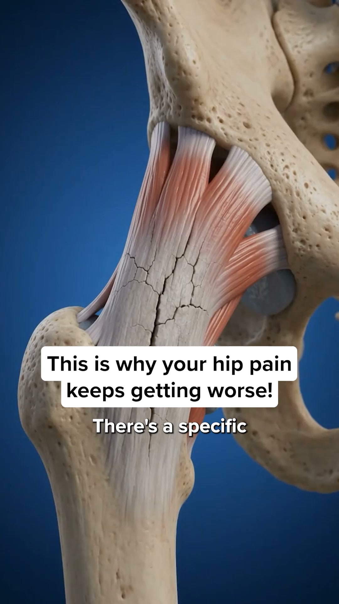 Say Goodbye to Arthritis Pain