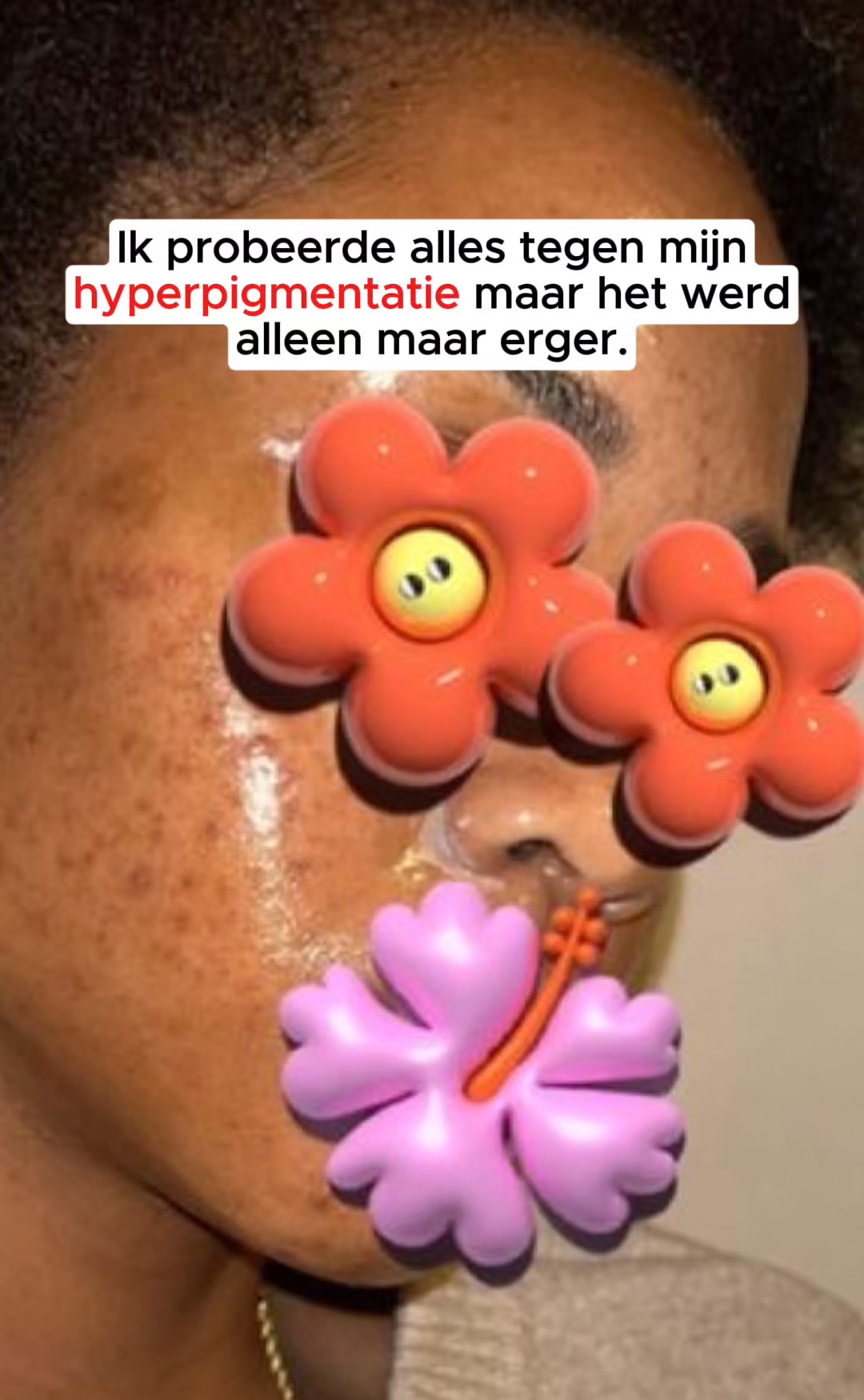 Vervaag Donkere Vlekken in 12 Weken