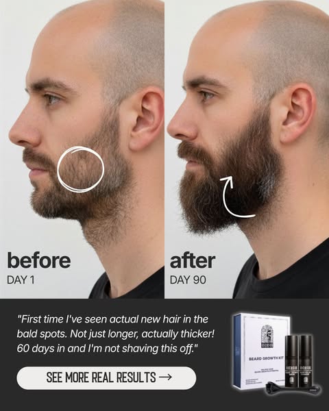 Real Beard Growth. Real Results.