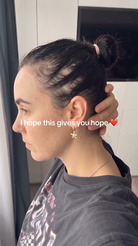 Imagine Your Hair 1 Year From Now