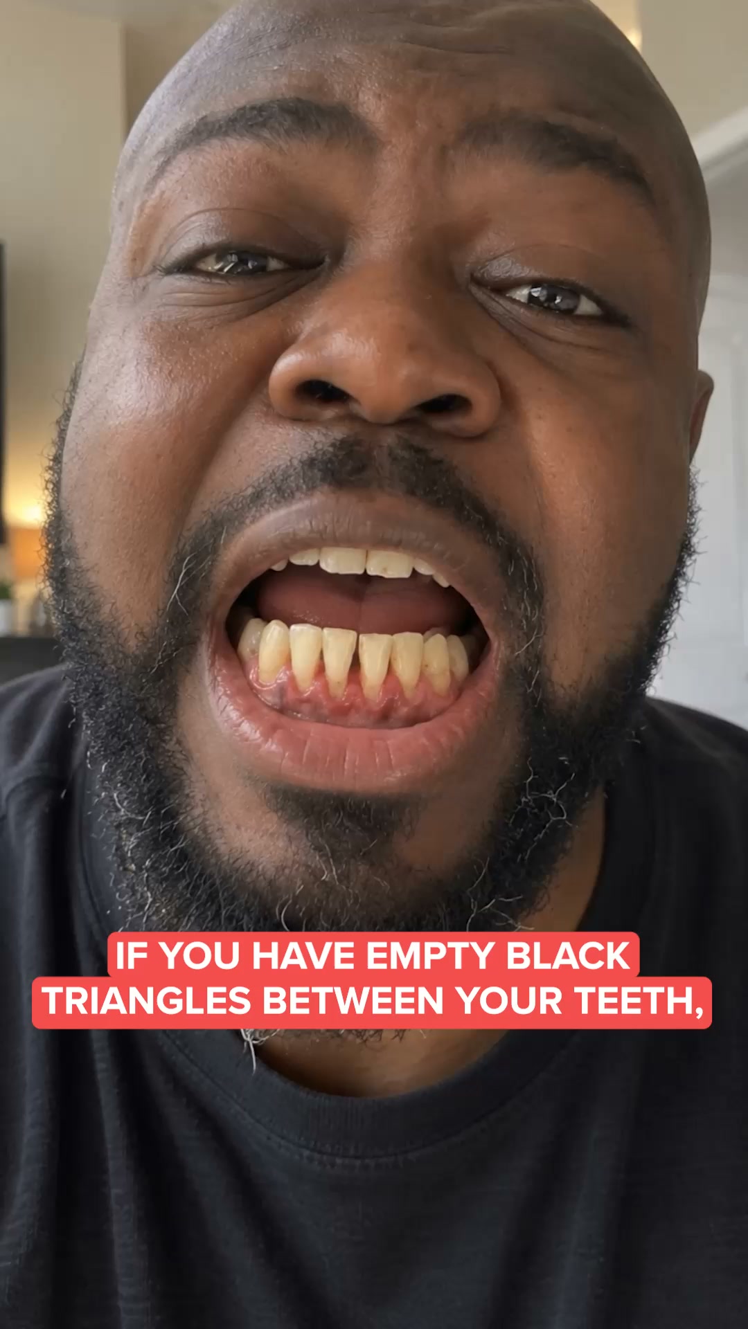 Try It Risk Free For 60 Days