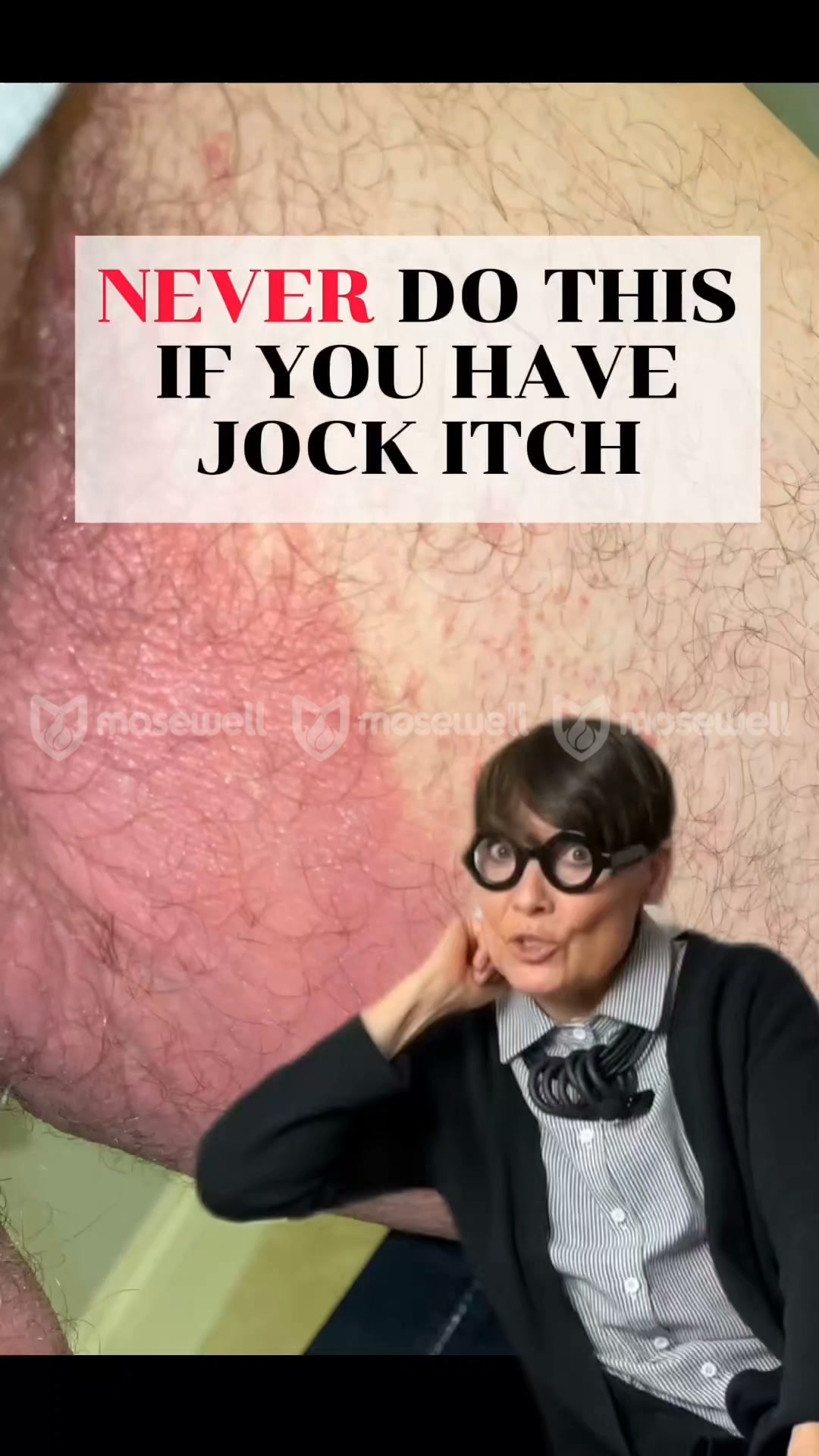 Jock Itch Hygiene: Use a Separate Towel