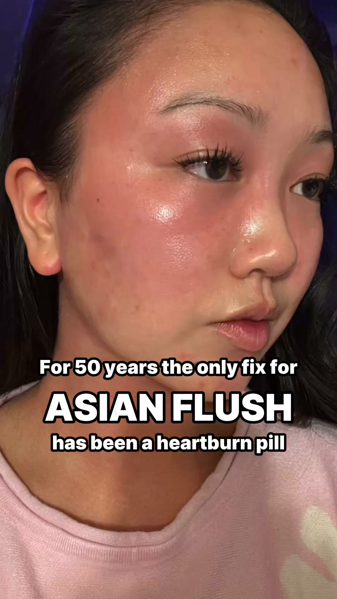 iBlush Alcohol Flush Starter Kit | Beat Drinking Redness & Discomfort