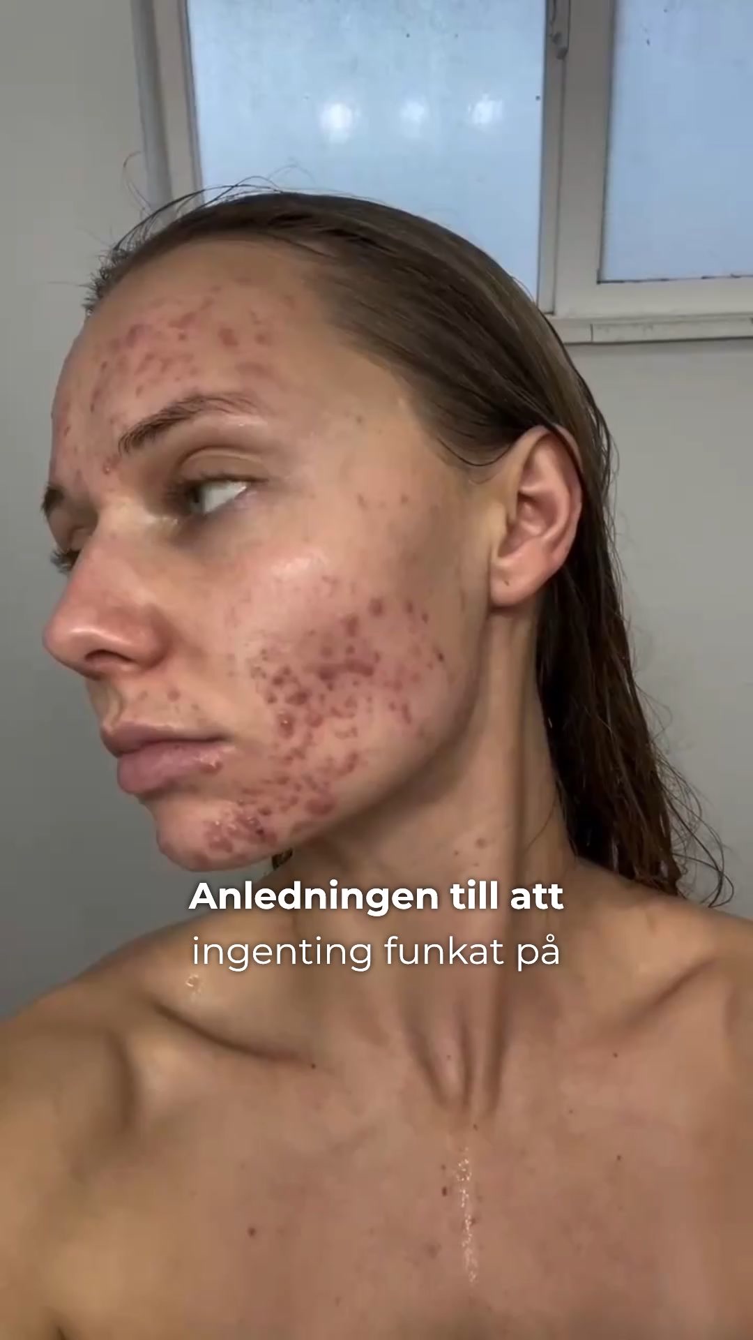 Naturlig djuprengöring
