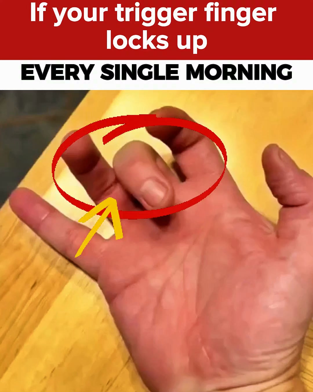 Finger Locking Every Morning?