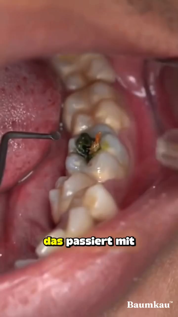 Was 74.000 Menschen täglich kauen