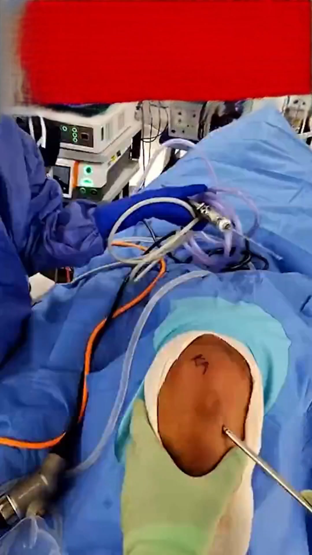 Ontdek meer comfort voor uw knieën met KneeRevive