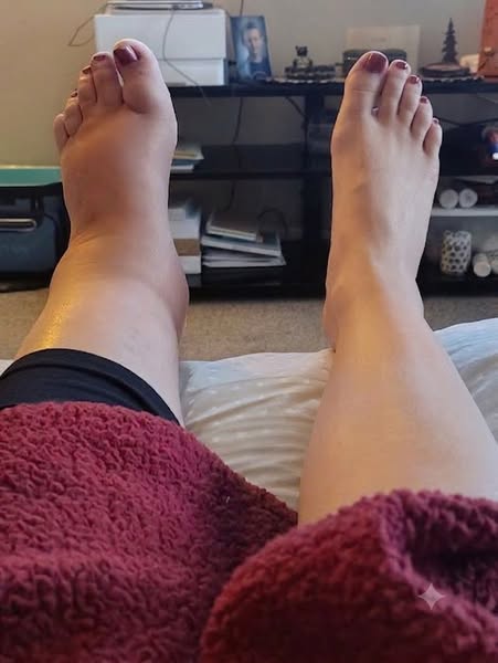 Get rid of swollen legs under 14 days!
