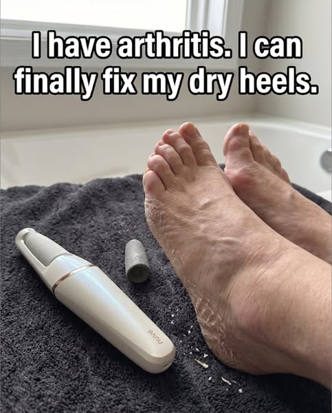 I have smooth heels!