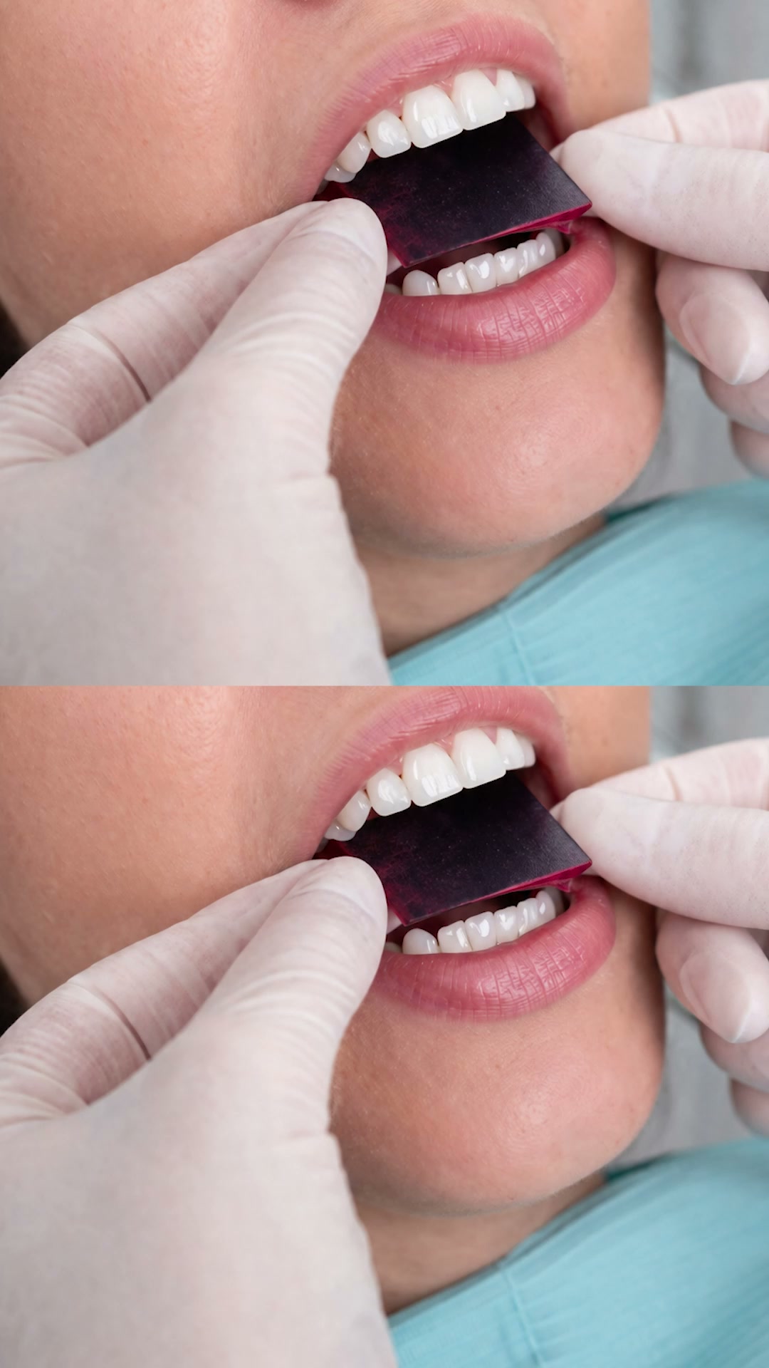 Master Occlusal Adjustments and Transform Your Clinical Results