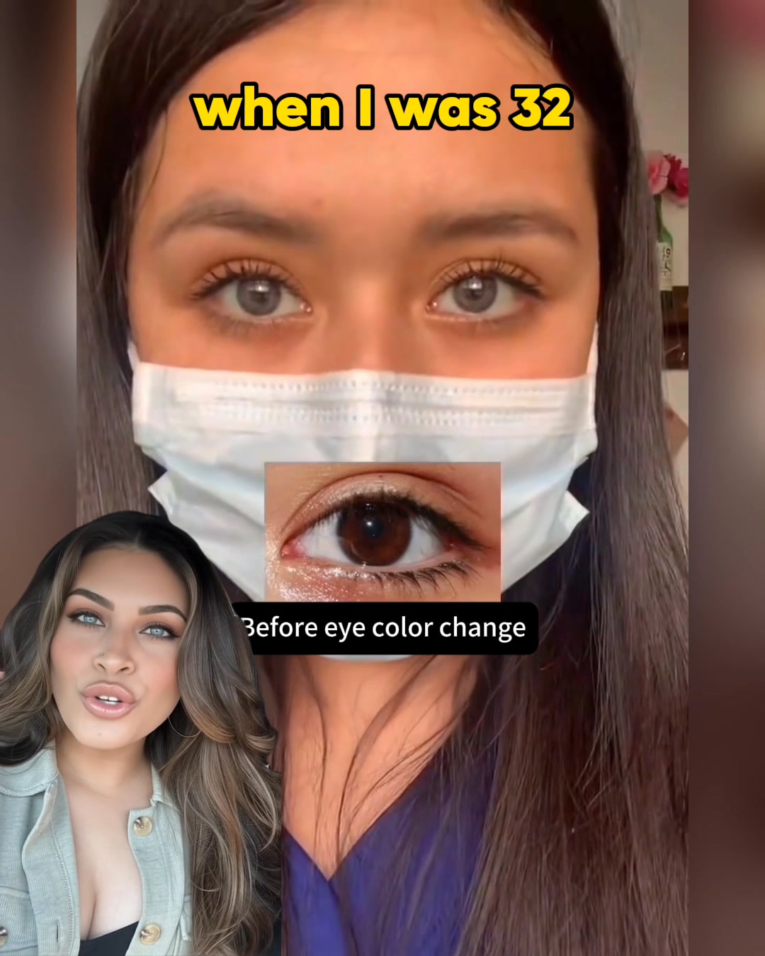 A Safer, Simpler Way to Brighter-Looking Eyes — Without the Hassle or Risks
