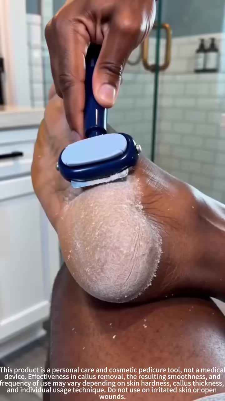 Foot callus remover