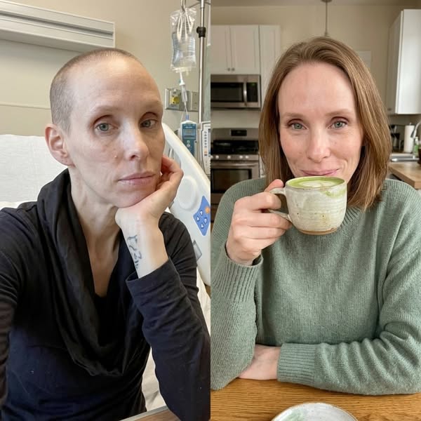This helped me stay in remission