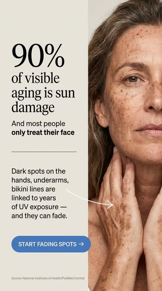 Why Sun Spots Hit the Hands First