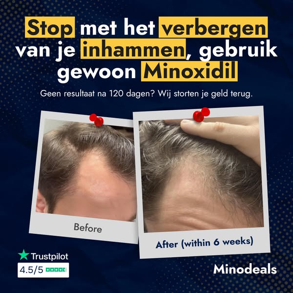 "Deze lotion gaf me dikker, gezonder haar"