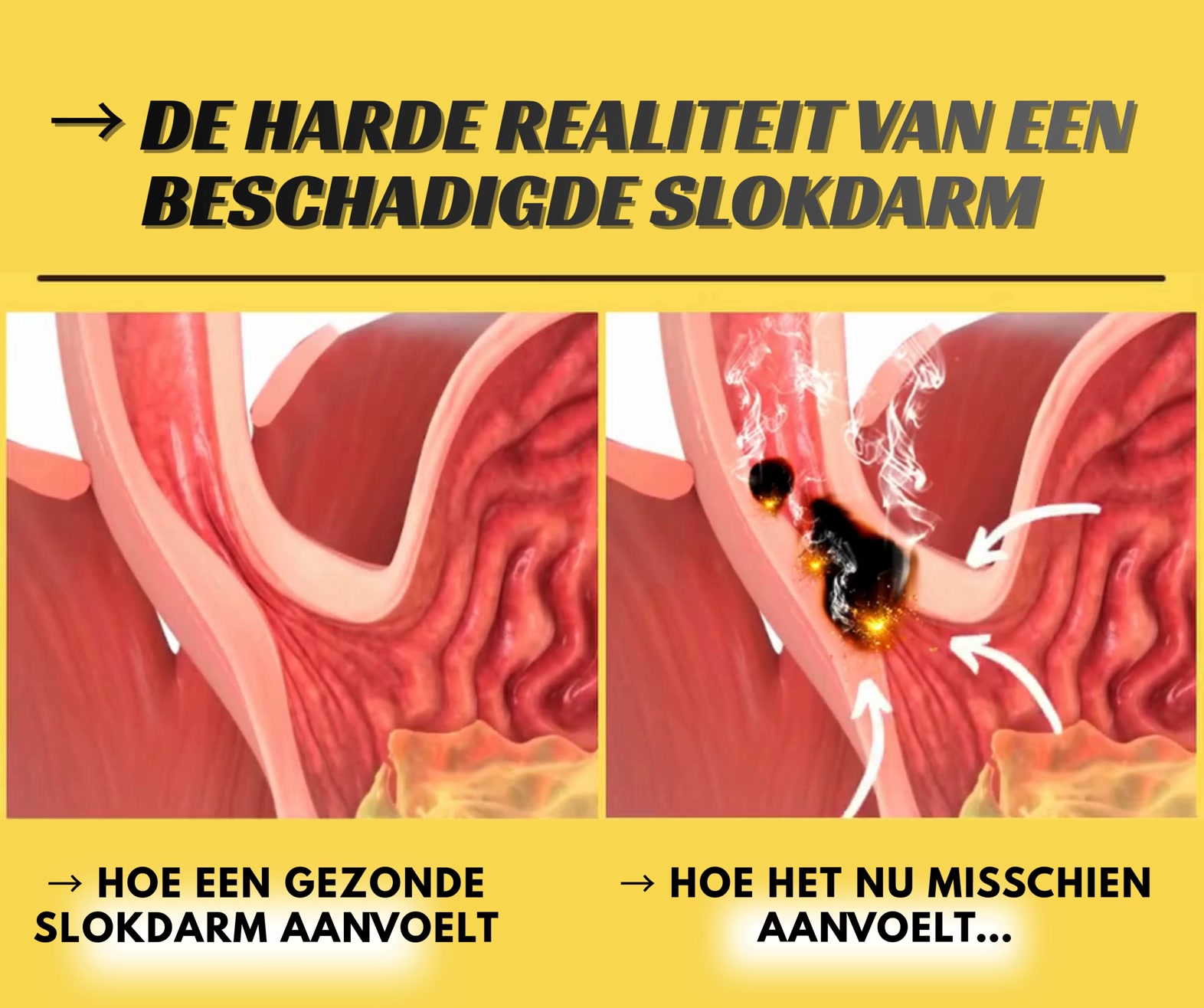 LAATSTE DAG 1 + 1 GRATIS - MIS HET NIET